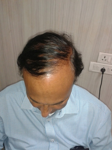 Hair Extensions in Gurgaon