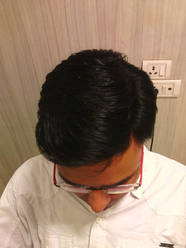 Hair Weaving Treatment In Delhi Hair Weaving Treatment In Delhi