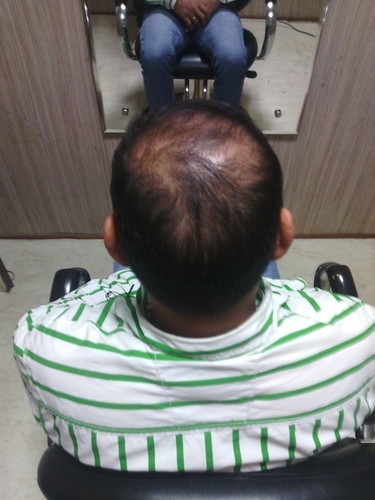 Hair Weaving in Delhi Ncr