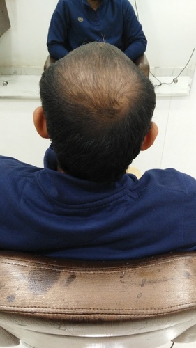 Hair Weaving in Noida