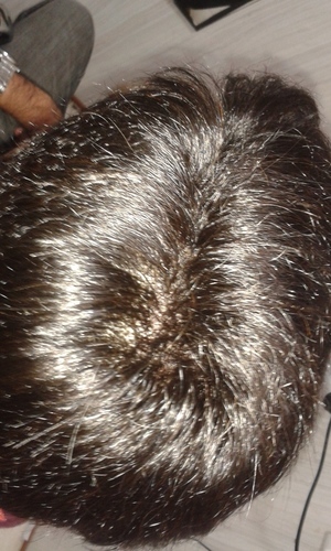 Hair Patch