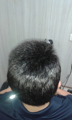 Hair Patches
