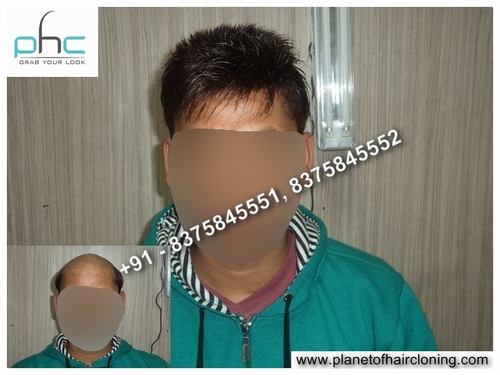 Hair Fixing Cost