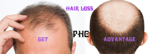Men's Hair Weaving fact service provider