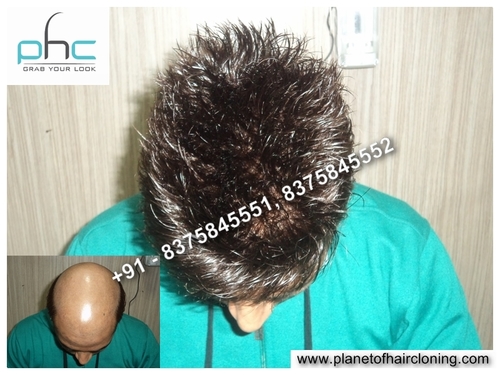 Best Hair Weaving or Artificial Hair Integration Cost effective Center