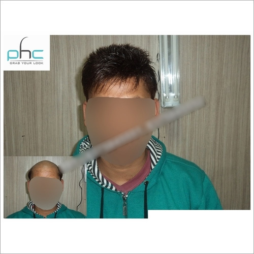Men's Wigs in Delhi India