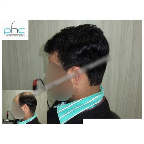 Women's Hair Wigs in Delhi India