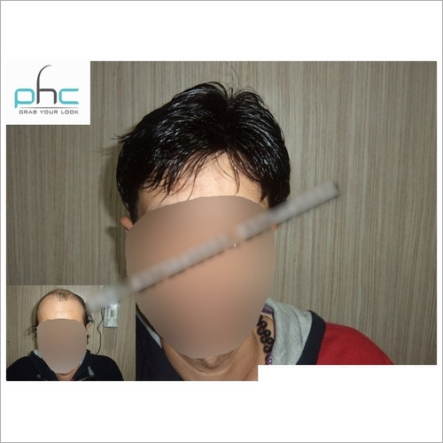 Hair Bonding Services in Delhi India
