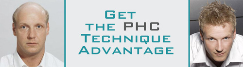 Hair Fixing Services - Client Hair, PHC Technique | Follicular Cloning, Hair Growth, Hair Restoration, Natural Look, 1-2 Weeks Recovery