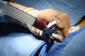 Multi Organ Transplant