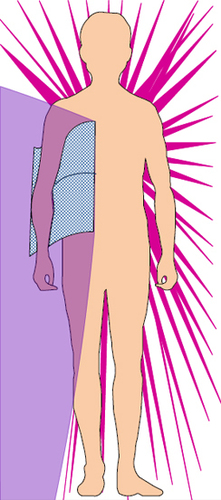 Fenestrated Radial Access Shield