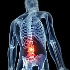 Micro Discectomy