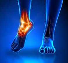 Foot and Ankle surgery