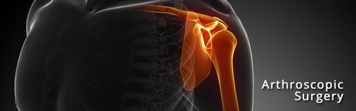 Arthroscopic Surgery
