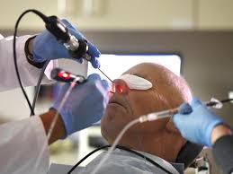 Nasal Surgery