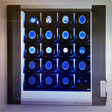 LED X Ray Films