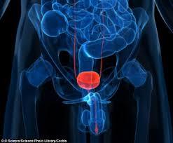 Prostate Cancer