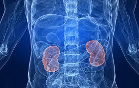 Kidney Cancer