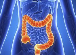 Colon Cancer