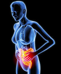 Inflammatory Bowel Disease
