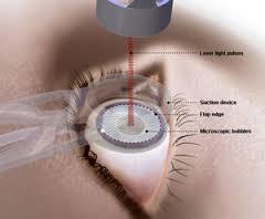 Ophthalmology 