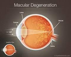 Age Related Macular Degeneration