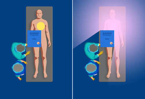 Femoral Access