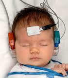 Baby Hearing Testing