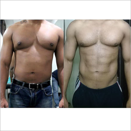 4D Body Contouring Surgery Services