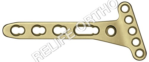 Volar Jextra Articular Plate