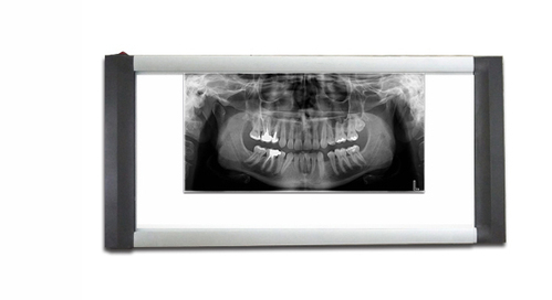 Dental X Ray Viewer
