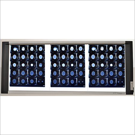 Triple Screen Led X Ray Viewer