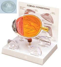 Cornea Eye Model