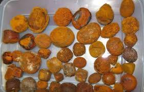 OX COW GALLSTONES