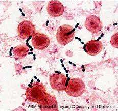 Enterococcus Faecalis