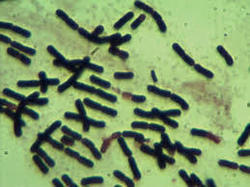 Clostridium Butyricum