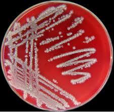 Bacillus Licheniformis