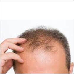 Hair Loss Treatment Services