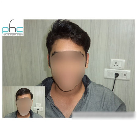 Mena s Hair Wigs in Delhi India