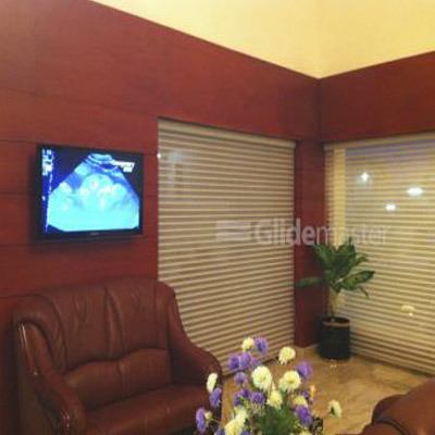 Automatic Residential Shutters