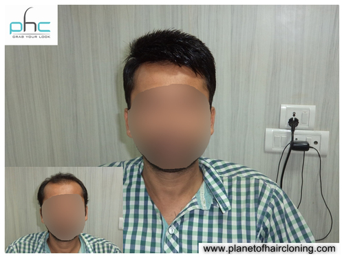 Wigs & Weaving (Best Shops) in Aiims, Delhi-110017, India | Hair Wigs in Aiims