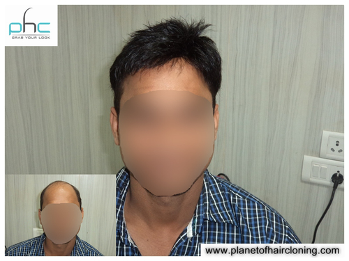 Womena s Hair Wigs (Best Shop) in Aiims, Delhi-110017, India- Women Lace Wigs in Aiims.