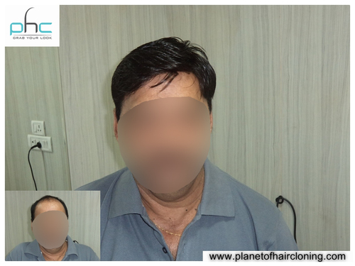 Men Hair Wigs (Best Store) in Ashok Vihar, Delhi-110052, India- Mena s Wig Manufacturers