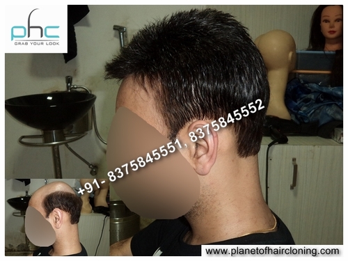 Mena s Hair Wigs (Best Shop) in Anand Parbhat, Delhi-110005, India- Men Lace wigs