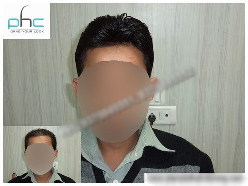 Mena s Hair Wigs (Best Shop) in Alipur, Delhi-110036, India- Men Lace Wigs in Alipur.
