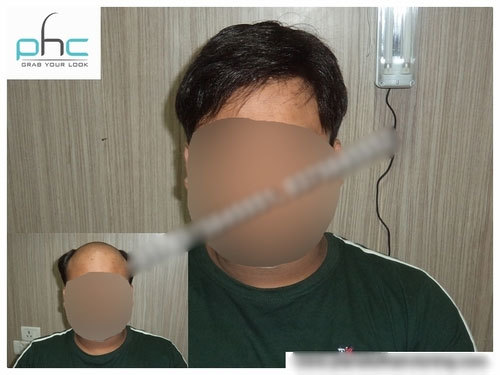 Men Lace Wigs - Human Hair, Customizable Size, Dark Brown, Lace Front, Natural Look, Comfortable Fit