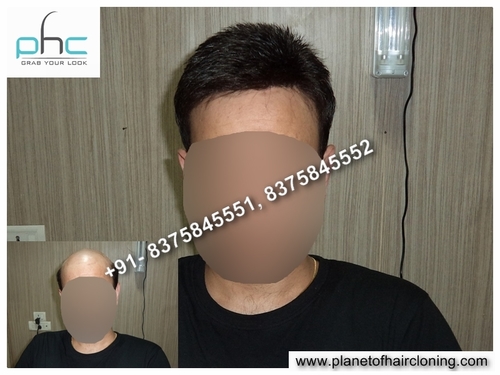 Mena s Hair Wigs (Best Shop) in Anand Vihar, Delhi-110092, India- Men Lace wigs