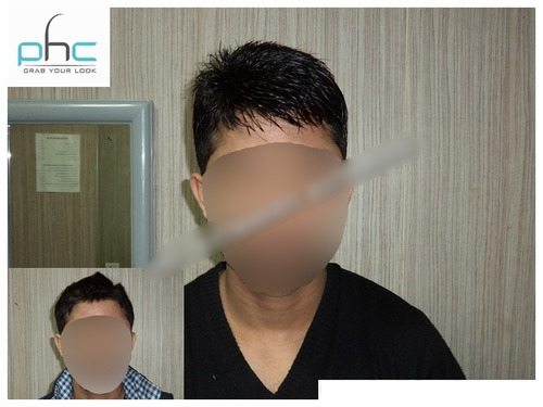 Where to Buy Good Hair Wigs at Best Price in Ashok Nagar, Delhi-110096, India| Buy Wigs - Human Hair, Custom Size, Black | Natural Look, Comfortable Fit, Durable