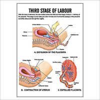 Labour Third Stage Model