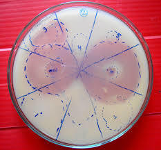 Phosphorus Solubilizing Bacteria